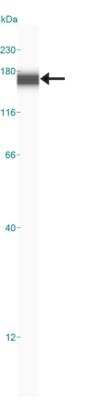 Simple Western: CD31/PECAM-1 AntibodyBSA Free [NBP1-71663]