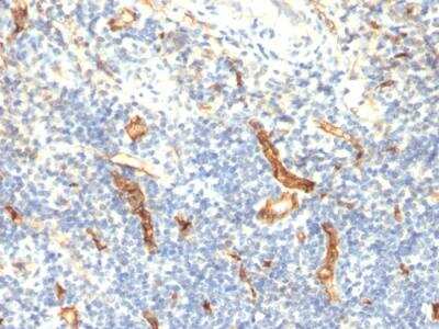 Immunohistochemistry-Paraffin: CD34 Antibody (HPCA1/1171) - IHC-Prediluted [NBP2-48363]