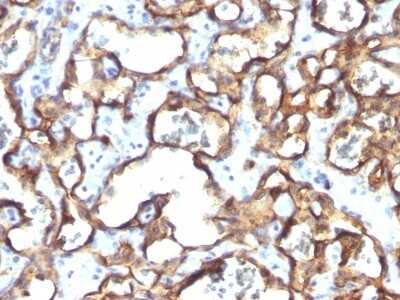 Immunohistochemistry-Paraffin: CD34 Antibody (HPCA1/1171) [NBP2-44569]