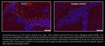 Immunocytochemistry/ Immunofluorescence: CD34 Antibody (HPCA1/763) [NBP2-44568]