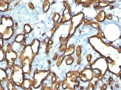 Immunohistochemistry-Paraffin: CD34 Antibody (HPCA1/763) [NBP2-44568]
