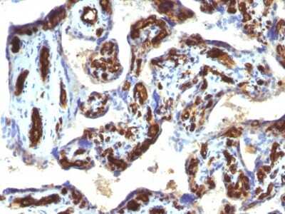 Immunohistochemistry-Paraffin: CD34 Antibody (HPCA1/763) [NBP2-44568]