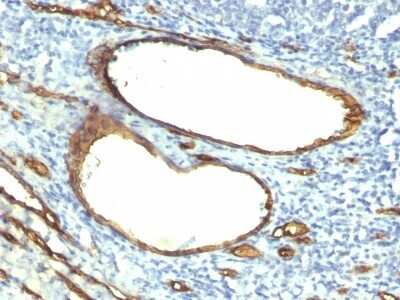 Immunohistochemistry-Paraffin: CD34 Antibody (HPCA1/763) [NBP2-44568]
