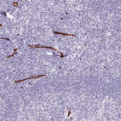 Immunohistochemistry-Paraffin: CD34 Antibody [NBP2-38321]