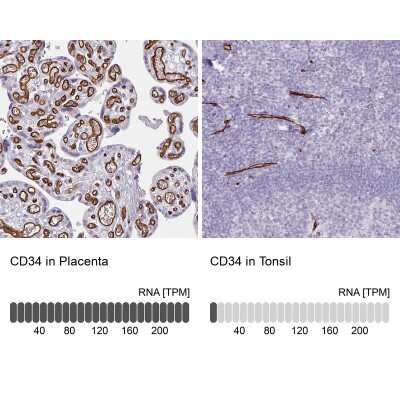 Immunohistochemistry-Paraffin: CD34 Antibody [NBP2-38321]