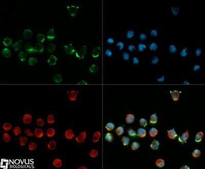 Immunocytochemistry/ Immunofluorescence: CD34 Antibody (MEC 14.7) - Azide and BSA Free [NBP2-80642]
