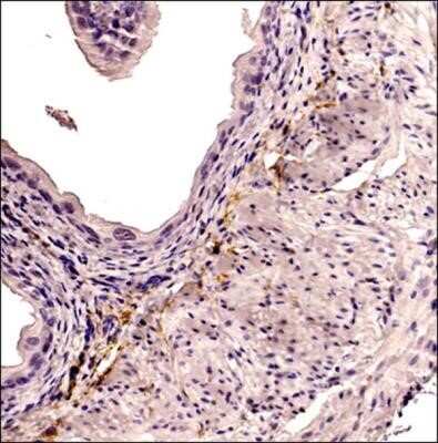 Immunohistochemistry: CD34 Antibody (MEC 14.7) - Azide and BSA Free [NBP2-80642]