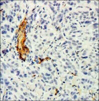 Immunohistochemistry-Paraffin: CD34 Antibody (MEC 14.7) - Azide and BSA Free [NBP2-80642]