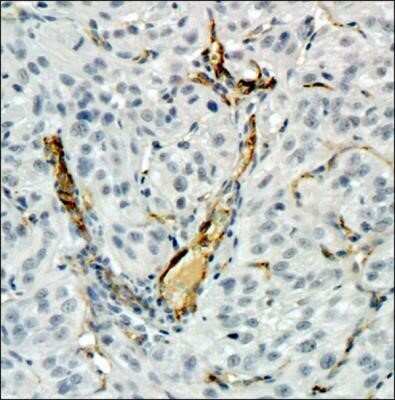Immunohistochemistry-Paraffin: CD34 Antibody (MEC 14.7) - Azide and BSA Free [NBP2-80642]
