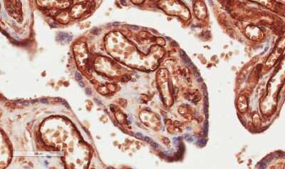Immunohistochemistry: CD34 Antibody (My10) - Chimeric - Azide and BSA Free [NBP2-62554]