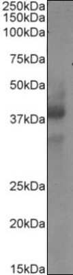 Western Blot: CD34 Antibody (My10)ChimericAzide and BSA Free [NBP2-62554]