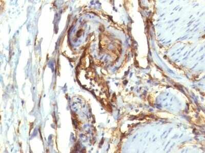 Immunohistochemistry-Paraffin: CD34 Antibody (QBEnd/10 + HPCA1/763) - Azide and BSA Free [NBP2-47909]