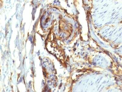 Immunohistochemistry-Paraffin: CD34 Antibody (QBEnd/10 + HPCA1/763) [NBP2-44567]