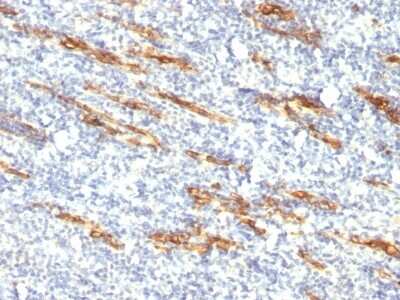 Immunohistochemistry-Paraffin: CD34 Antibody (QBEnd/10 + HPCA1/763) [NBP2-44567]