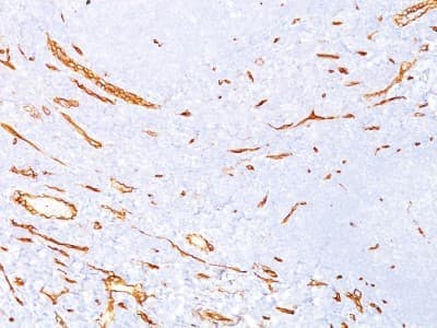 Immunohistochemistry-Paraffin: CD34 Antibody (QBEnd/10) - BSA Free [NBP2-32932]