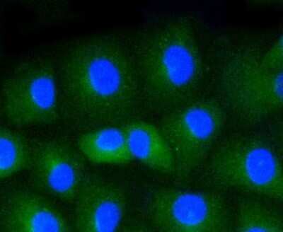 Immunocytochemistry/ Immunofluorescence: CD34 Antibody (SI16-01) [NBP2-67399]