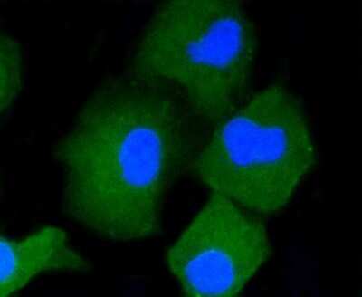Immunocytochemistry/ Immunofluorescence: CD34 Antibody (SI16-01) [NBP2-67399]
