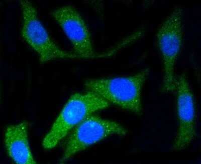 Immunocytochemistry/ Immunofluorescence: CD34 Antibody (SI16-01) [NBP2-67399]