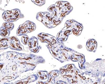 Immunohistochemistry-Paraffin: CD34 Antibody (SI16-01) [NBP2-67399]