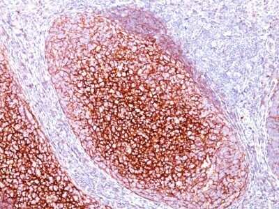 Immunohistochemistry-Paraffin: CD35 Antibody (CR1/802) - Azide and BSA Free [NBP2-47865]