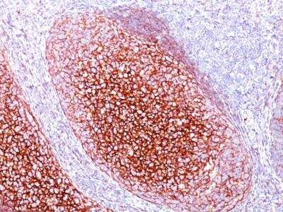 Immunohistochemistry-Paraffin: CD35 Antibody (CR1/802) - IHC-Prediluted [NBP2-48365]
