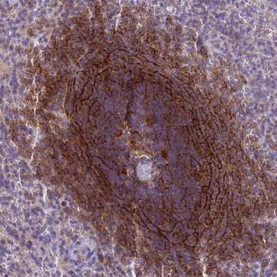 Immunohistochemistry-Paraffin: CD35 Antibody [NBP2-13871]