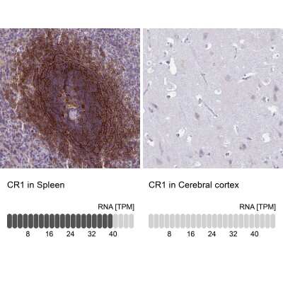 Immunohistochemistry-Paraffin: CD35 Antibody [NBP2-13871]