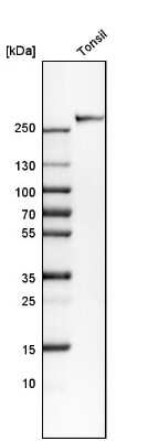 Western Blot: CD35 Antibody [NBP2-13872]
