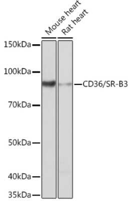 Western Blot: CD36 Antibody (7P0S7) [NBP3-15616]