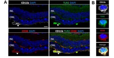 Immunohistochemistry: CD36 Antibody - BSA Free [NB400-145]