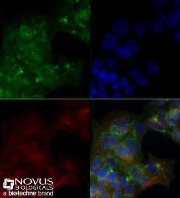 Immunocytochemistry/ Immunofluorescence: CD36 Antibody (1283D) - BSA Free [NBP2-54790]