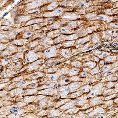 Immunohistochemistry-Paraffin: CD36 Antibody (1283D) - BSA Free [NBP2-54790]