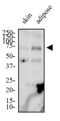 Western Blot: CD36 Antibody (1283D)BSA Free [NBP2-54790]