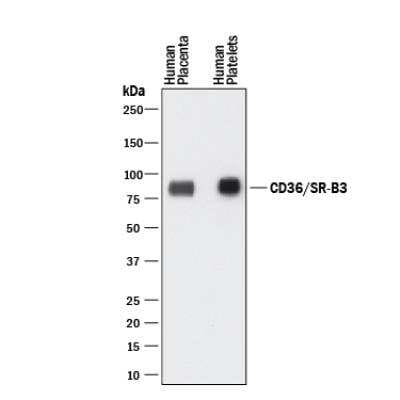 Western Blot: CD36 Antibody (1283D)BSA Free [NBP2-54790]