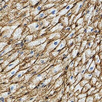 Immunohistochemistry: CD36 Antibody (877302) - Azide and BSA Free [MAB19553]