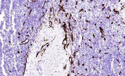 Immunohistochemistry-Frozen: CD36 Antibody (FA6-152) [NB600-1423]