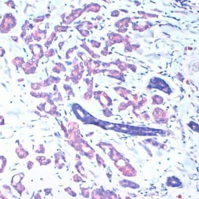 Immunohistochemistry-Paraffin: CD36 Antibody (FA6-152) [NB600-1423]