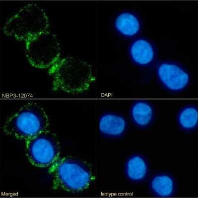 Immunocytochemistry/ Immunofluorescence: CD37 Antibody (IPO-24 (ZC37-24)) - Chimeric - Azide and BSA Free [NBP3-12074]