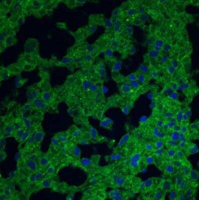 Immunocytochemistry/ Immunofluorescence: CD38 Antibody (1G7F4) - Azide Free [NBP2-25265]