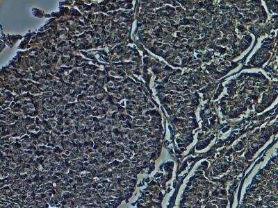 Immunohistochemistry-Frozen: CD38 Antibody (1G7F4) - Azide Free [NBP2-25265]