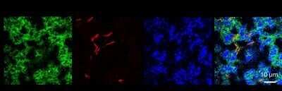Immunohistochemistry: CD38 Antibody (1G7F4) - Azide Free [NBP2-25265]