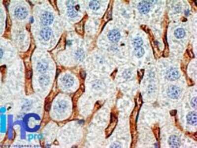Immunohistochemistry-Paraffin: CD38 Antibody (1G7F4) - Azide Free [NBP2-25265]