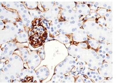 Immunohistochemistry-Paraffin: CD38 Antibody (32) [NBP2-90470]