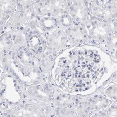 Immunohistochemistry-Paraffin: CD38 Antibody [NBP1-86010]