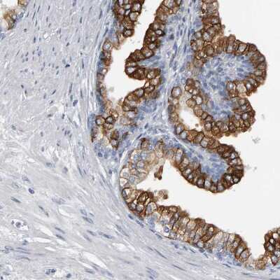 Immunohistochemistry-Paraffin: CD38 Antibody [NBP1-86010]