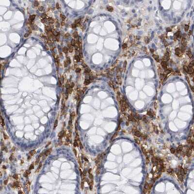 Immunohistochemistry-Paraffin: CD38 Antibody [NBP1-86010]