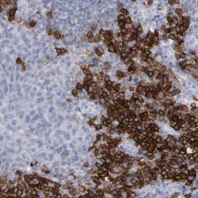 Immunohistochemistry-Paraffin: CD38 Antibody [NBP1-86010]