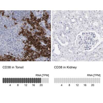 Immunohistochemistry-Paraffin: CD38 Antibody [NBP1-86010]