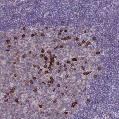 Immunohistochemistry-Paraffin: CD38 Antibody [NBP2-38668]