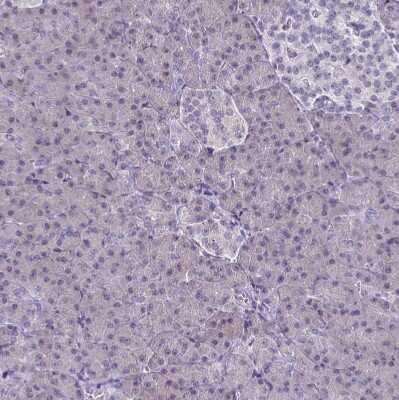 Immunohistochemistry-Paraffin: CD38 Antibody [NBP2-38668]
